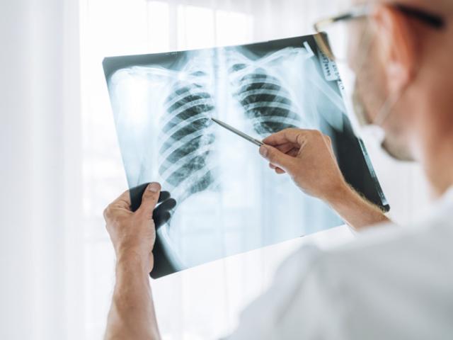 Médico revisa posibles manchas en los pulmones 