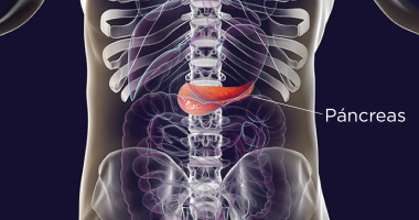 diabetes tipo 2 y páncreas